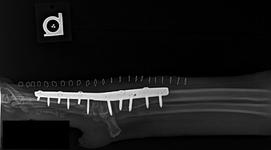 Pancarpal arthrodesis surgery to fuse a severely damaged wrist